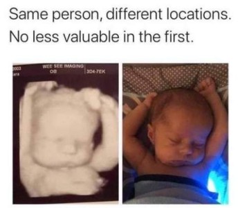 Two photos; first shows a 3D picture of a baby before birth, laying on his back, chin resting on the left side of his chest, arms over his head...second shows the same baby laying on his back, chin resting on the left side of his chest, arms over his head on a bed. Caption: Same person, different locations. No less valuable in the first.